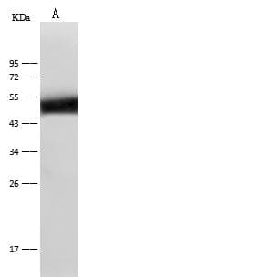 KRT14 / CK14 / Cytokeratin 14 Antibody (Preservative Free)