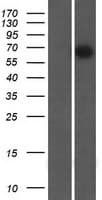 KIAA0828 / AHCYL2 Protein (Over-Expression Lysate Myc-DDK (Flag))
