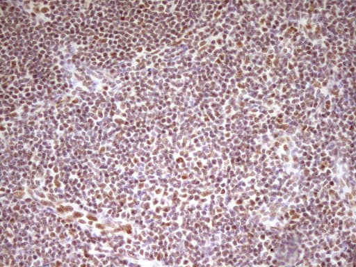 HMG20A Antibody (aa1-281, clone OTI2H4)