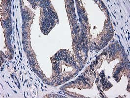 SULT1C2 / Sulfotransferase 1C2 Antibody (clone OTI4G1)