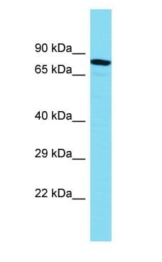 MTMR10 Antibody (aa603-652)