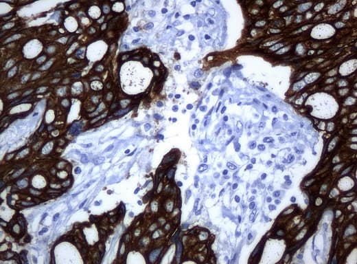 KRT19 / CK19 / Cytokeratin 19 Antibody (aa240-390, clone UMAB2)