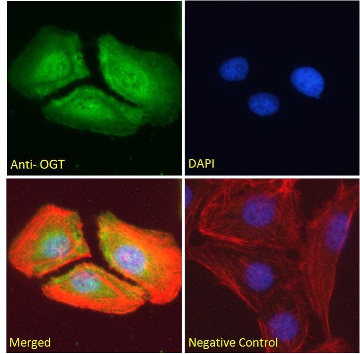 IHC-plus™ OGT / O-GLCNAC Antibody (aa543-555)