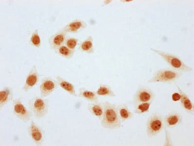 Polyclonal Rabbit anti-Human HIST1H1E Antibody (WB)