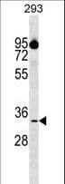 CIAPIN1 / Anamorsin Antibody (aa81-108)