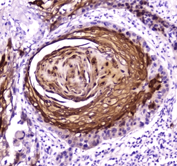 Polyclonal Rabbit anti-Human E-FABP / FABP5 Antibody (IHC, WB)