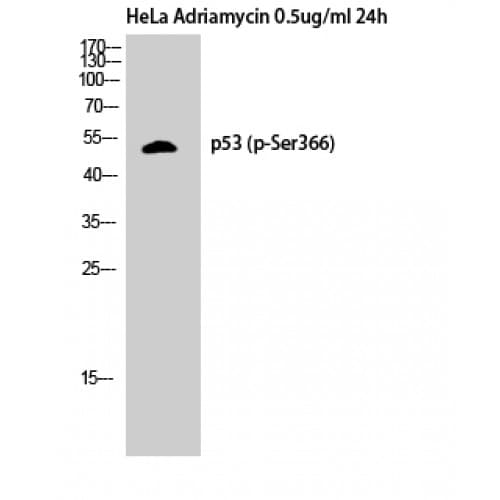 Polyclonal Rabbit anti-Human TP53 / p53 Antibody (300-380 aa, IHC, WB)