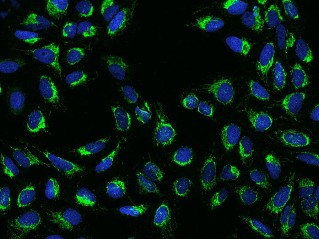 Polyclonal Rabbit anti-Human MT-CO3 / COX3 / COXIII Antibody (IHC, IF)