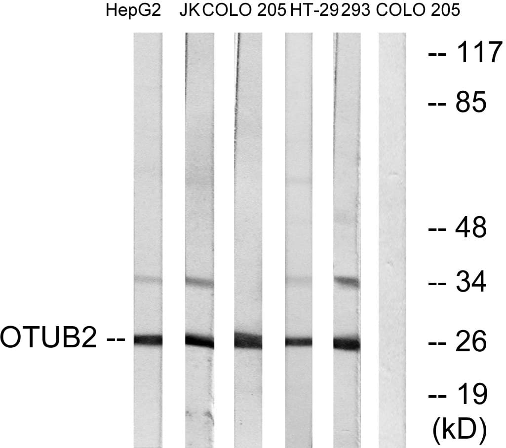 IHC-plus™ OTUB2 Antibody (aa133-182)