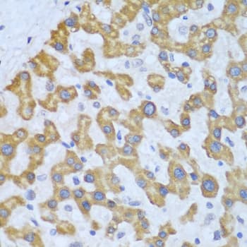 PRKCD / PKC-Delta Antibody