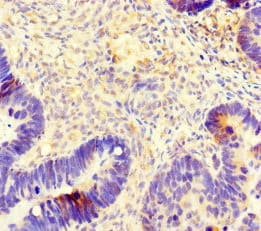 TUBB4 / Tubulin Beta 4 Antibody