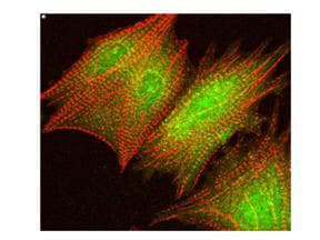 AKT1 + AKT2 + AKT3 Antibody (phospho-Ser473)