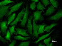 Monoclonal Mouse anti-Human Transportin-SR / TNPO3 Antibody (clone 3152C2a, IF, WB)