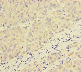 Polyclonal Rabbit anti-Human PEX16 Antibody (IHC)