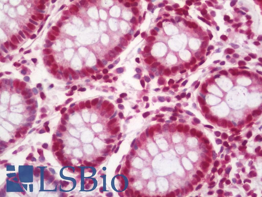 IHC-plus™ HOXB7 Antibody (aa94-122)