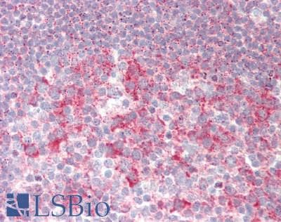 IHC-plus™ RPL30 / Ribosomal Protein L30 Antibody (aa62-111)