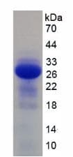 Mouse IL2RB / CD122 Protein (Recombinant His)