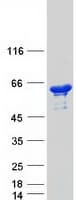 Human DDX19B Protein (Recombinant Myc-DDK (Flag))