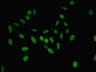 ANXA11 / Annexin XI Antibody (aa276-505)