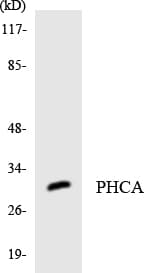 ACER3 Antibody (aa160-209)