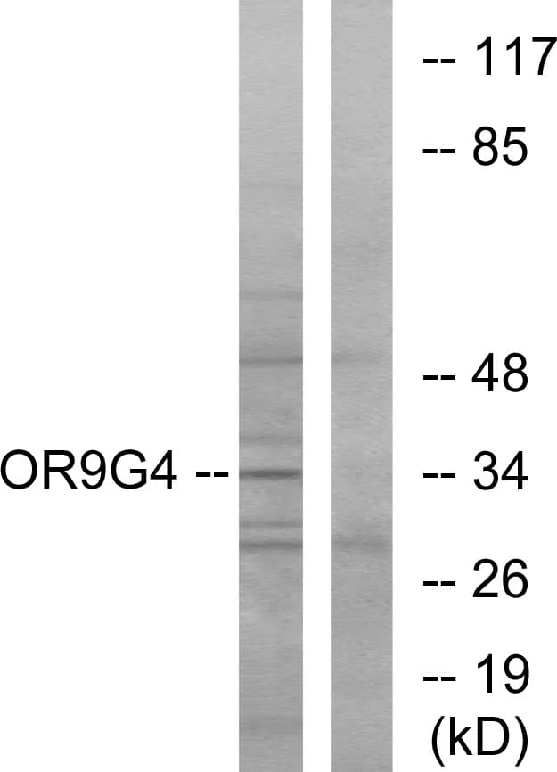 OR9G4 Antibody (aa278-327)