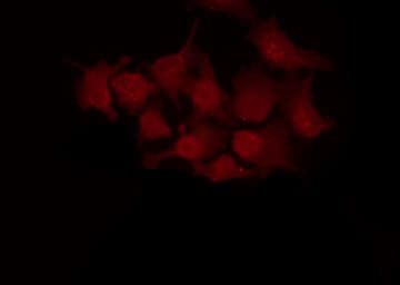 CDKN1B / p27 Kip1 Antibody