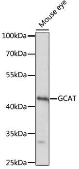 Polyclonal Rabbit anti-Human GCAT Antibody (IHC, IF, WB)