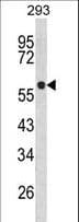 TPH1 / Tryptophan Hydroxylase Antibody (aa35-62)
