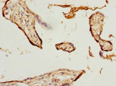 ZNF232 Antibody