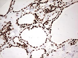 Monoclonal Mouse anti-Human HNRPM / HNRNPM Antibody (clone OTI3F3, aa1-261, IHC, WB)