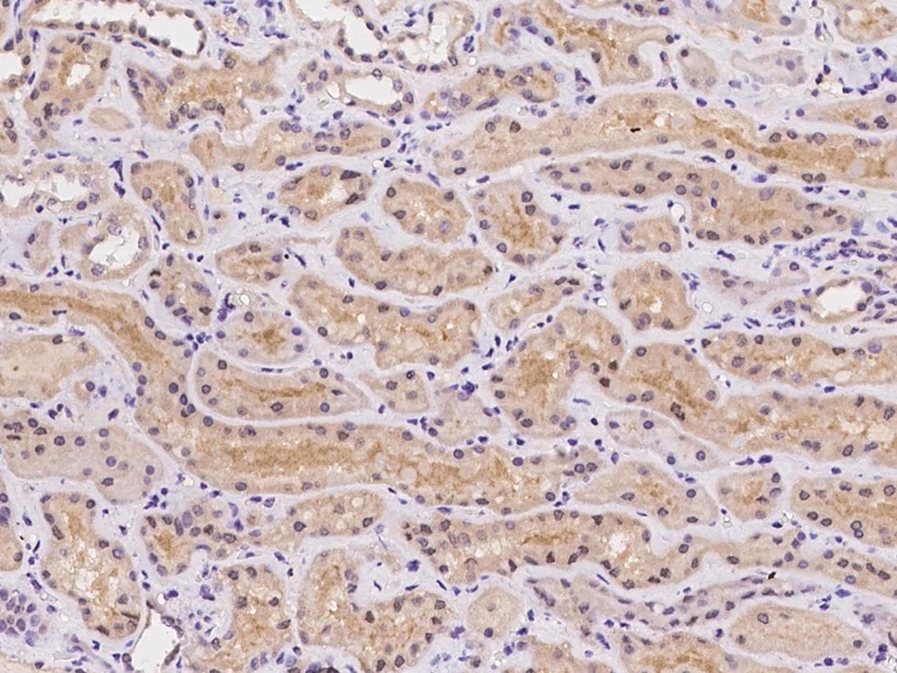 Polyclonal Rabbit anti-Human LRRC4C Antibody (IHC)