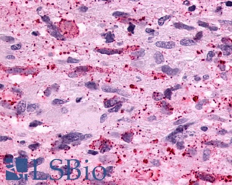 IHC-plus™ Polyclonal Rabbit anti-Human PTGER3 / EP3 Antibody (Cytoplasmic Domain, IHC)
