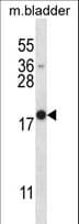 MYOG / Myogenin Antibody (aa30-58)