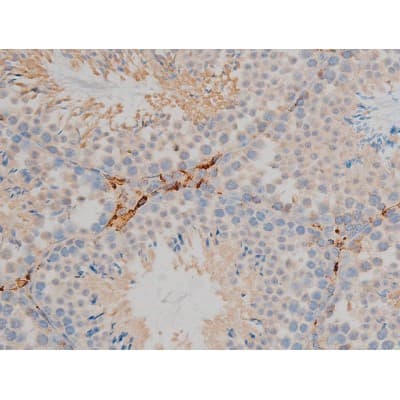 Polyclonal Rabbit anti-Human BCL2 / Bcl-2 Antibody (phospho-Ser70, IHC, IF, WB)
