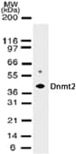 IHC-plus™ TRDMT1 / DNMT2 Antibody (clone 102B1259.2)