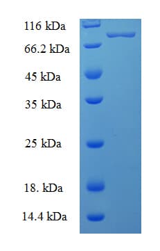 Human PNKP Protein (Recombinant His-SUMO)