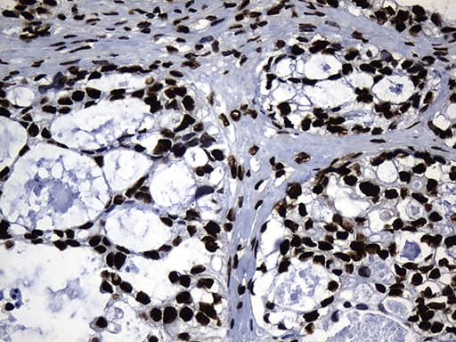 HNRNPH1 / hnRNP H Antibody (clone OTI2D11, Carrier-free)