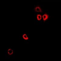 Polyclonal Rabbit anti-Human PTS Antibody (IF, WB)