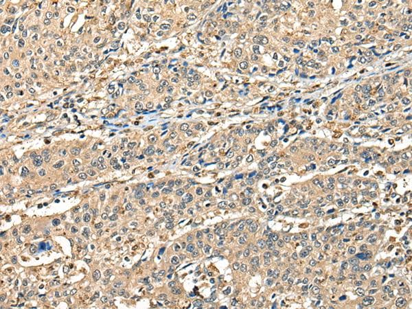 Polyclonal Rabbit anti-Human CCDC112 / MBC1 Antibody (IHC)