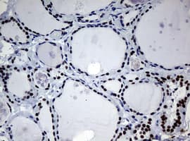 NBN / Nibrin Antibody (aa183-460, clone OTI2F5, Carrier-free)