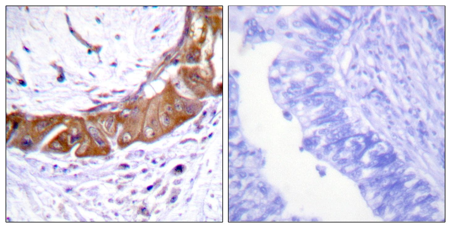IRAK1 / IRAK Antibody (phospho-Thr100)