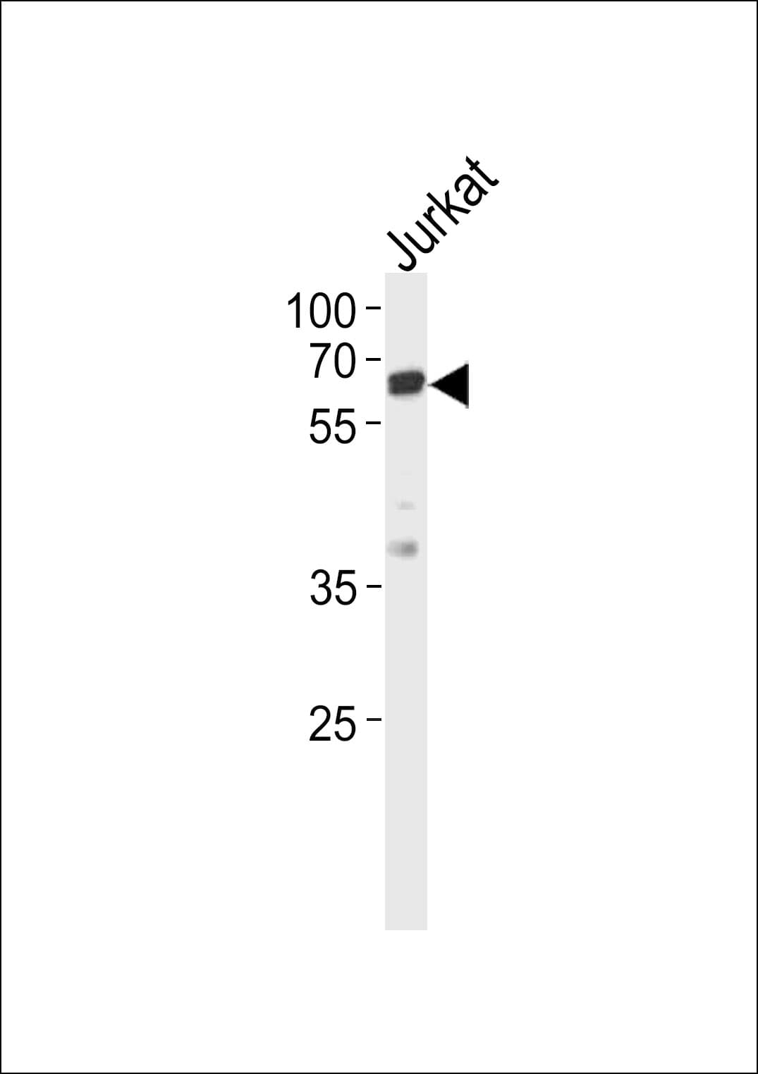 ZAP70 Antibody (aa276-304)
