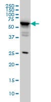 Monoclonal Mouse anti-Human DDX56 Antibody (clone 4C5, IHC, IF, WB)