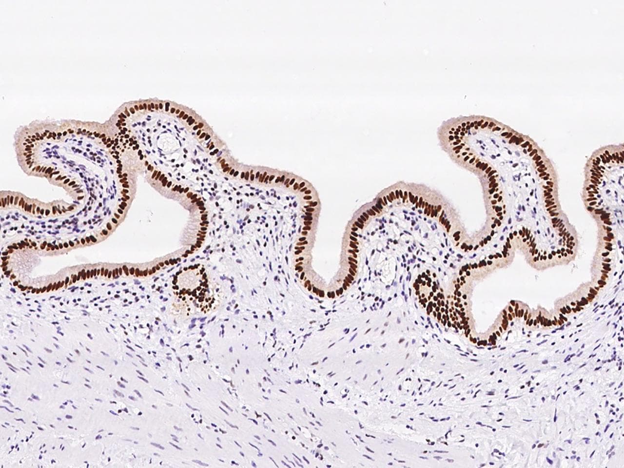 Polyclonal Rabbit anti-Human PAPSS 1 Antibody (IHC, IF, WB)