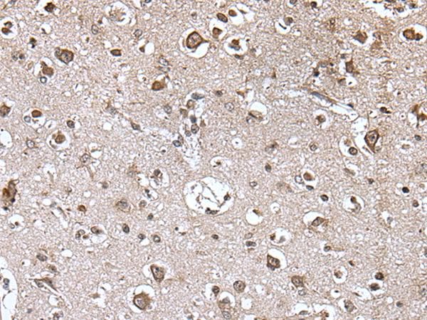 TRIM27 Antibody