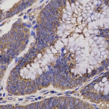 EPHX2 / Epoxide Hydrolase 2 Antibody