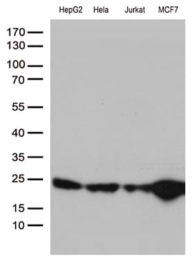 MGMT Antibody (clone OTI6C4)