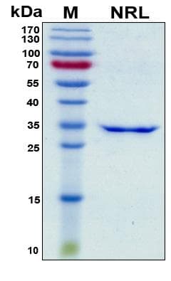 Human NRL Protein (Recombinant His, N-Terminal)
