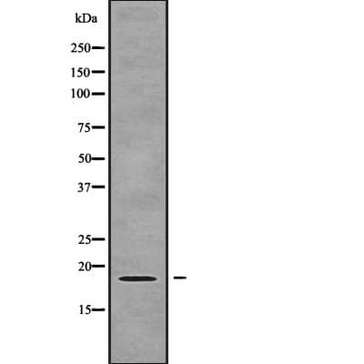 ZNHIT1 Antibody
