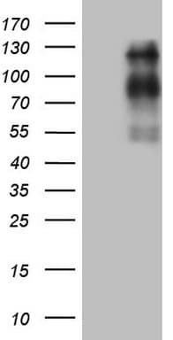 Monoclonal Mouse anti-Human USP53 Antibody (clone OTI3C9, aa495-582, WB)